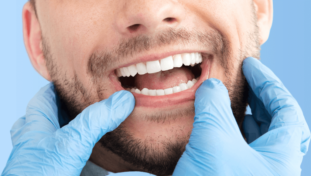 Dents saines Afbeelding